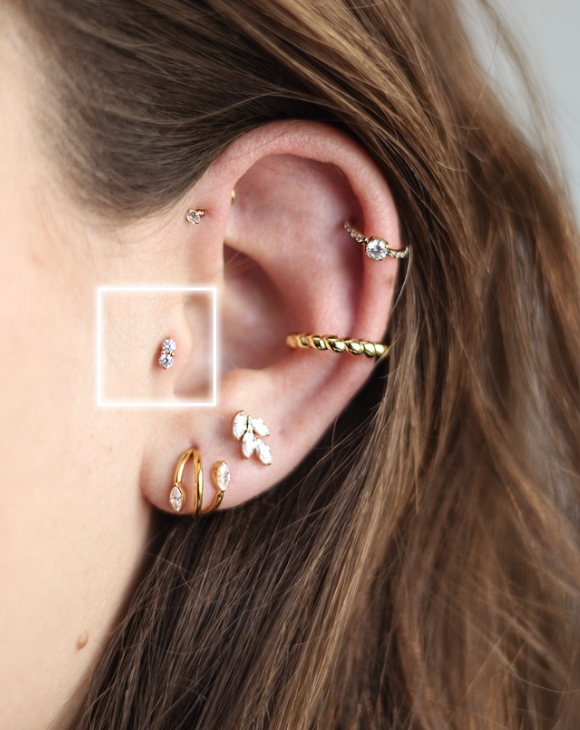 TRAGUS