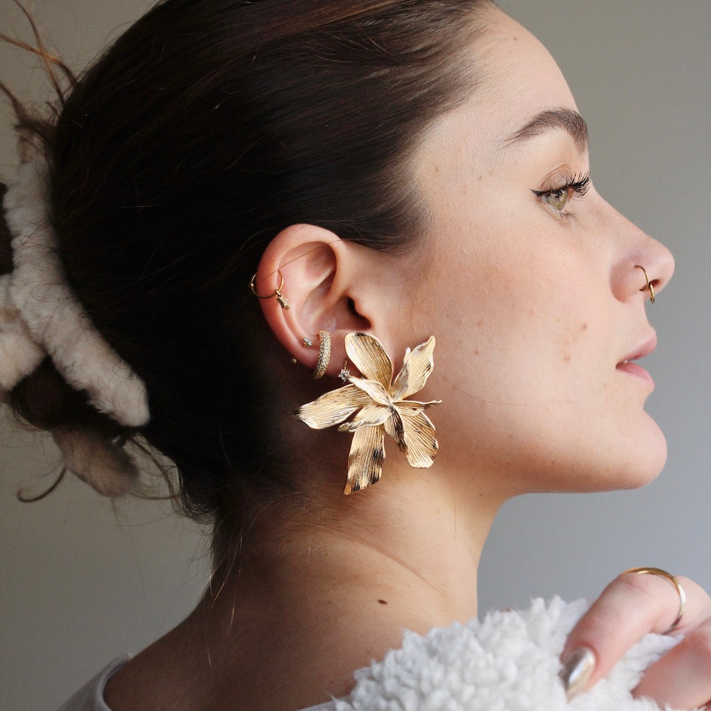 ARETES DALIS