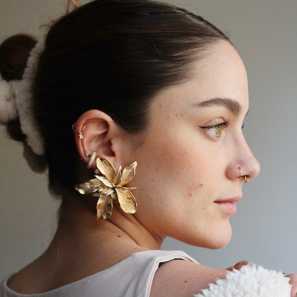ARETES DALIS