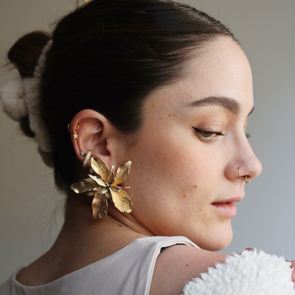 ARETES DALIS